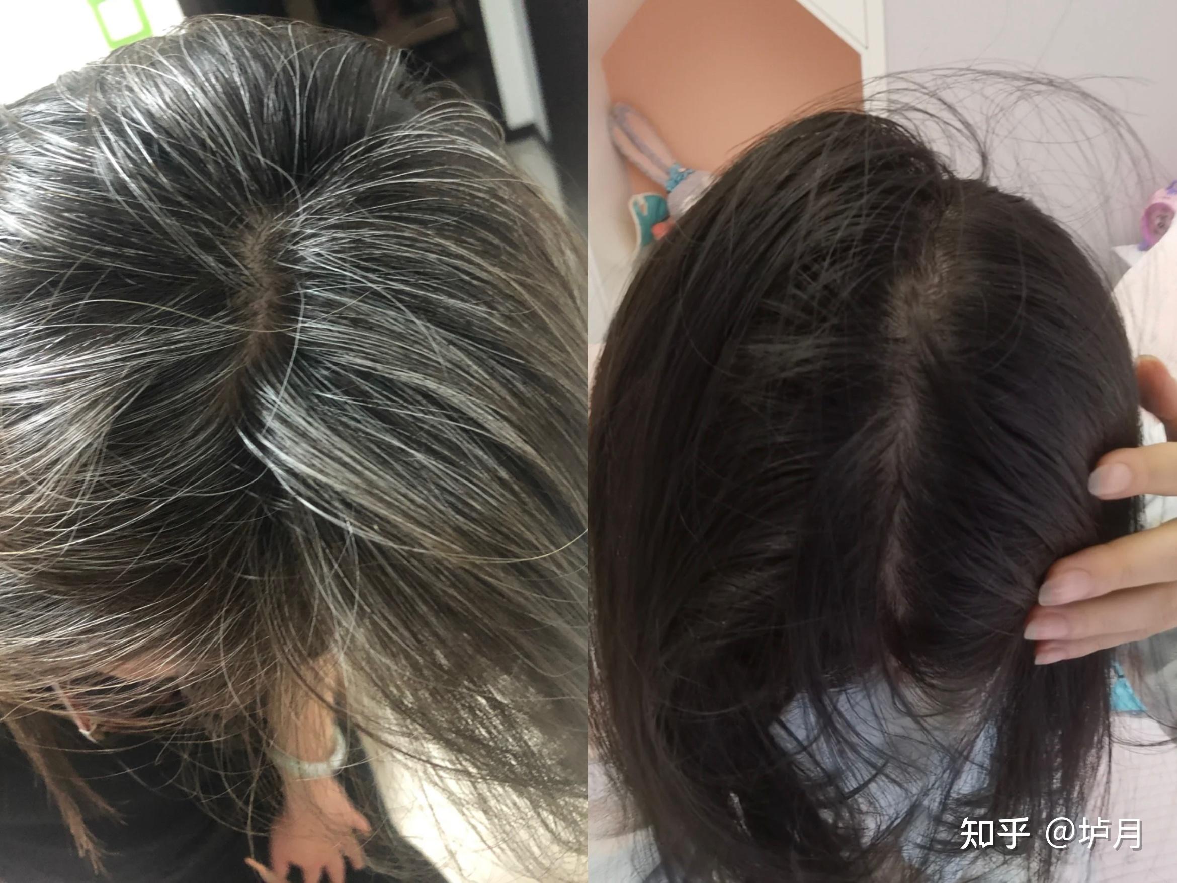 白头发超级多,有什么白发转黑发的好方法或者好一点的乌发洗.